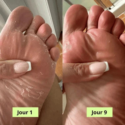 Savon Purifiant PuraPedi™